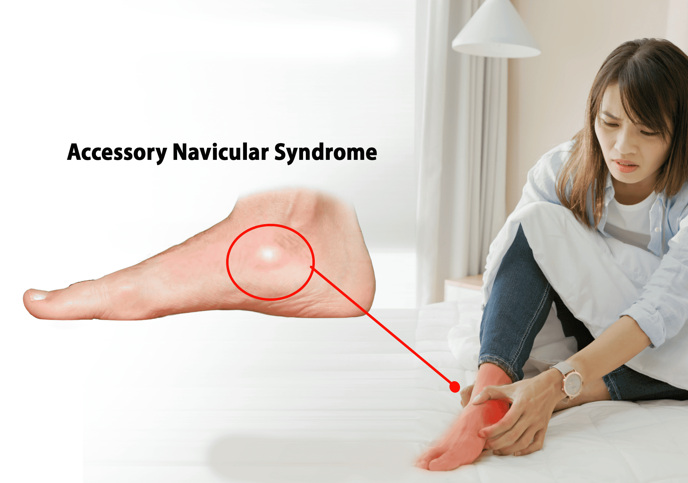 Mengenal Accessory Navicular Syndrome Klinik Tulang Belakang