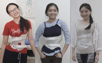 7 Alasan kenapa Pasien Scoliosis memilih Brace GBW