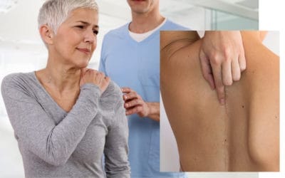 Rehabilitasi Pasien Scoliosis Post-operasi dan Manula dengan terapi Akupuntur