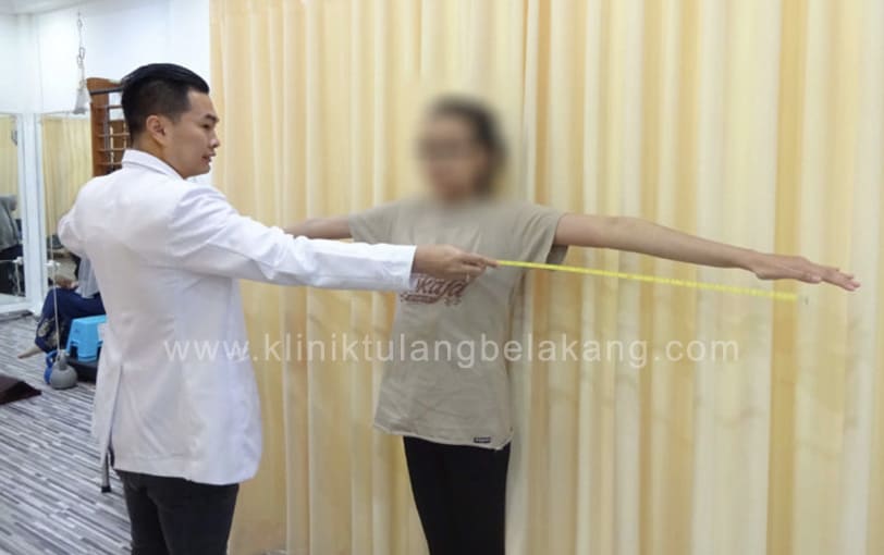 Skoliosis dan kelainan Sindrom Marfan yang perlu Anda ketahui