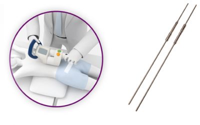 Magec Rods: Operasi Skoliosis Teknik Baru yang perlu Dipertanyakan