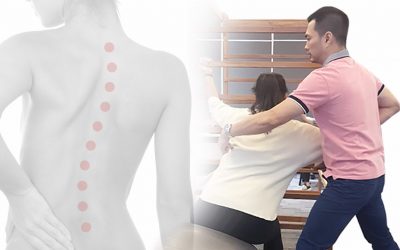 Terapi Schroth Dapat Menyeimbangkan Aktivitas Otot Pada Skoliosis