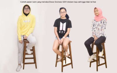Stylish Dengan Braces Skoliosis GBW! Tetap Percaya Diri!