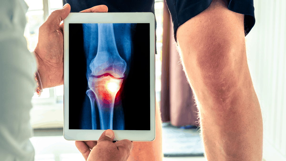 gangguan pada sendi lutut/ knee joint