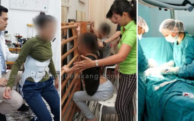 Waktu Operasi Skoliosis: Pengertian, Prosedur, dan Pertimbangan Penting