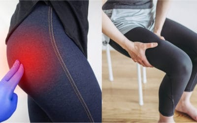 Nyeri Paha, apakah termasuk Sindrom Piriformis? Ini 5 Gejalanya!