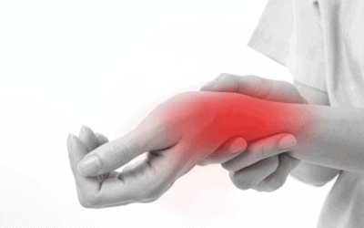 Nyeri Sendi Pergelangan Tangan? Hati-hati De Quervain Syndrome
