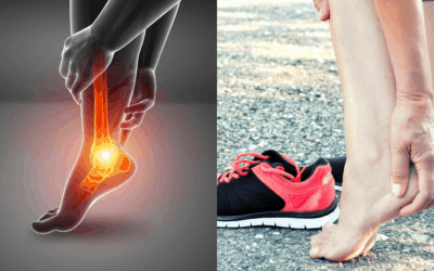 Nyeri Tumit? Coba 4 Cara Obat Rumahan yang Dianjurkan Ini!