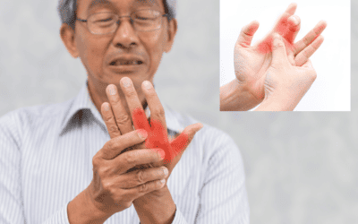 Jari Kaku ? Jangan-jangan Kamu Mengalami Trigger Finger