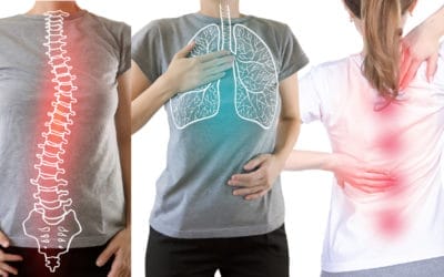 Bahaya Skoliosis pada Tumbuh Kembang Anak Anda