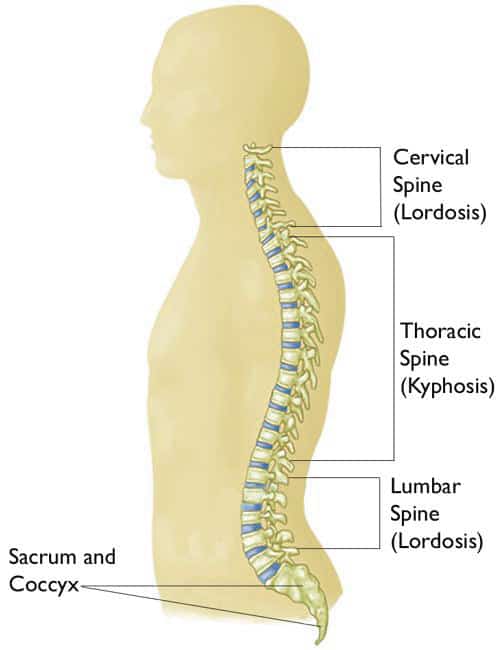 flat back, flat back syndrome