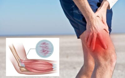 Mengatasi pegal / Nyeri otot akibat DOMS setelah Berolahraga