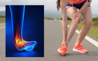 Cedera Ankle/Ankle Sprain/Keseleo pada Pergelangan Kaki