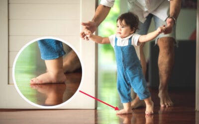 Kaki Datar Pada Balita, Wajarkah?