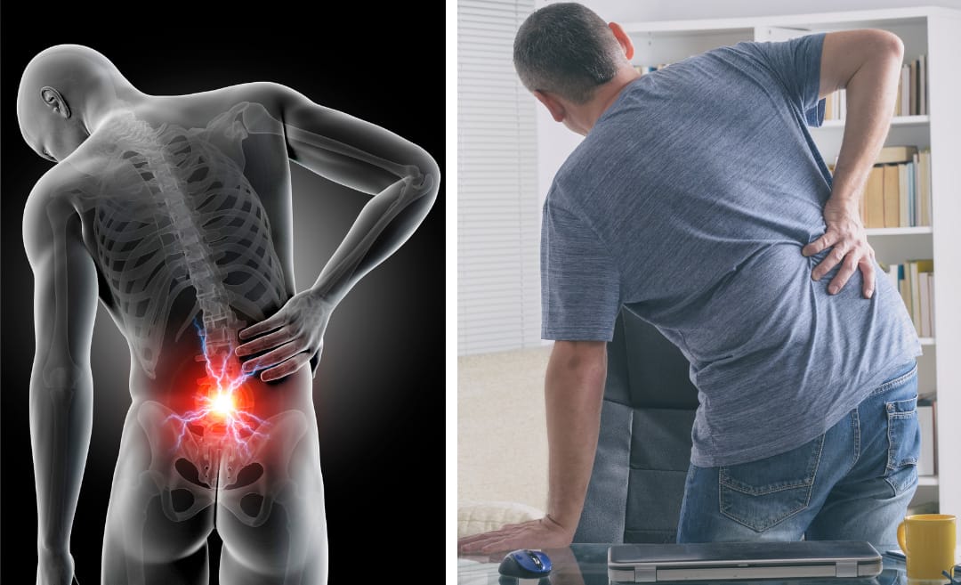 Low back pain,low back pain adalah,low back pain exercise,sakit pinggang