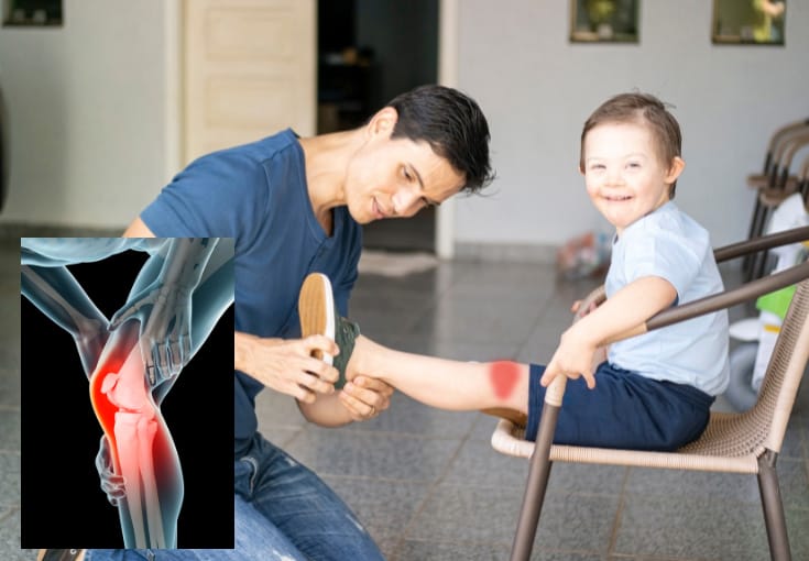 Mengenal Joint Hypermobility Syndrome | Klinik Tulang Belakang