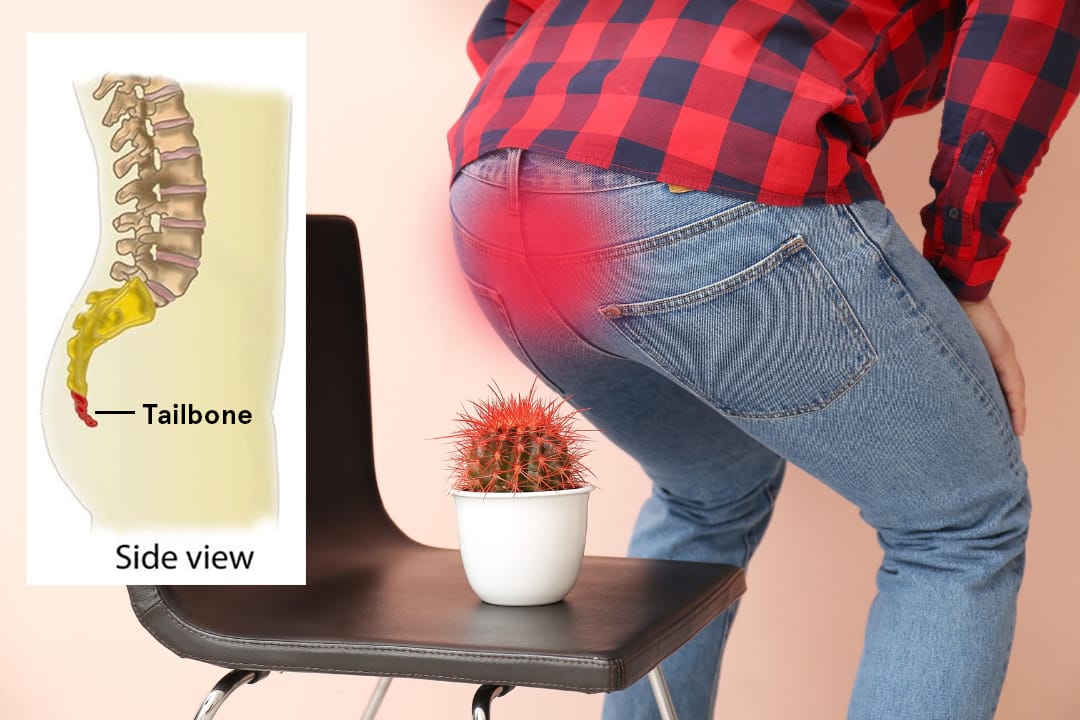 Tailbone-Pain