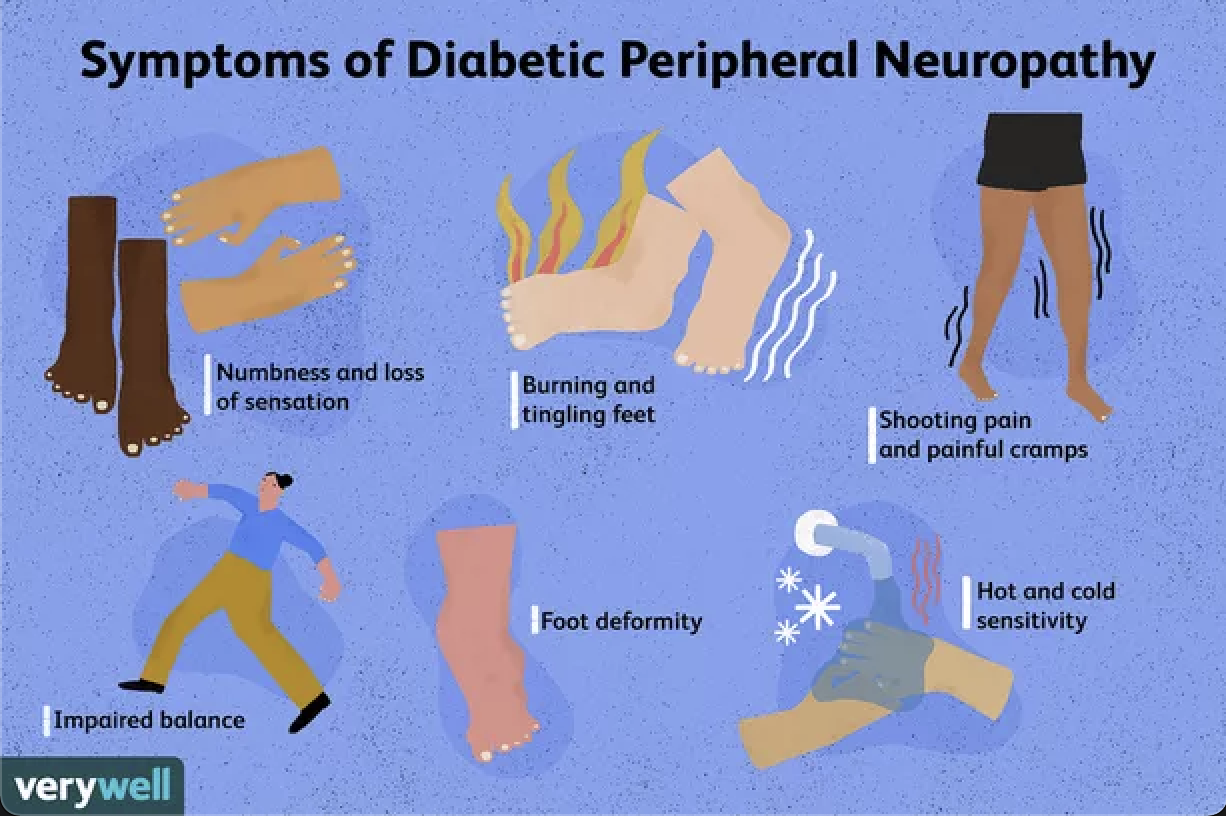 Diabetic Neuropathy, Diabetes