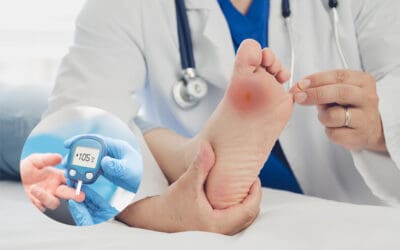 Tips Mengatasi Luka Pada Penderita Diabetes