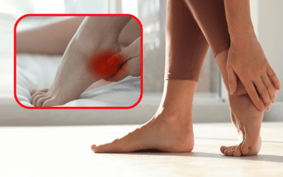 Nyeri Pada Telapak Kaki Akibat Plantar Fasciitis (Radang Jaringan Telapak Kaki)