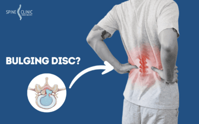 Apa itu Bulging Disc Pada Tulang Belakang?