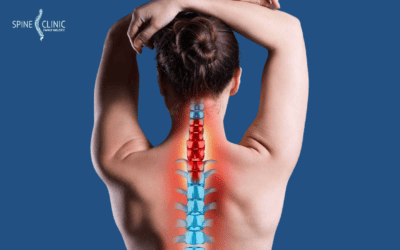 Radikulopati Servikal: Semua yang Perlu Kamu Ketahui