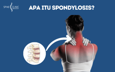 Spondilosis Tidak Dapat Disembuhkan, Tapi Bisa Ditangani